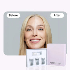 Élysilk Timeless MicroNeedle-Infusion Anti-Aging System